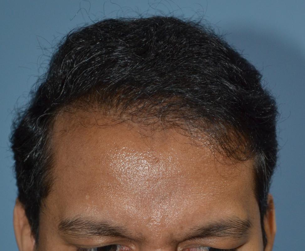 Click image for larger version

Name:	Darling Buds Hair Transplant Clinic (12).jpg

Size:	94.6 KB
ID:	57489