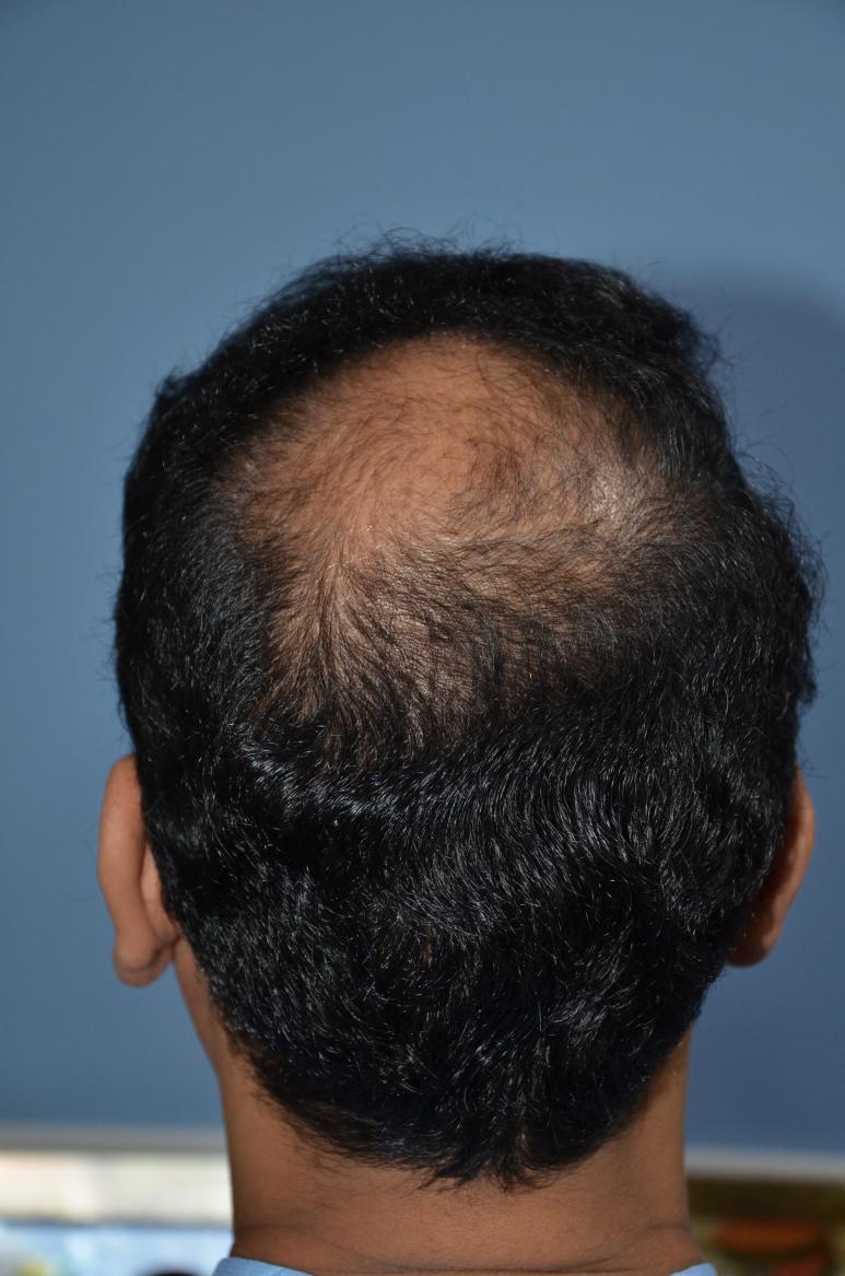 Click image for larger version

Name:	Darling Buds Hair Transplant Clinic (13).jpg

Size:	94.8 KB
ID:	57490