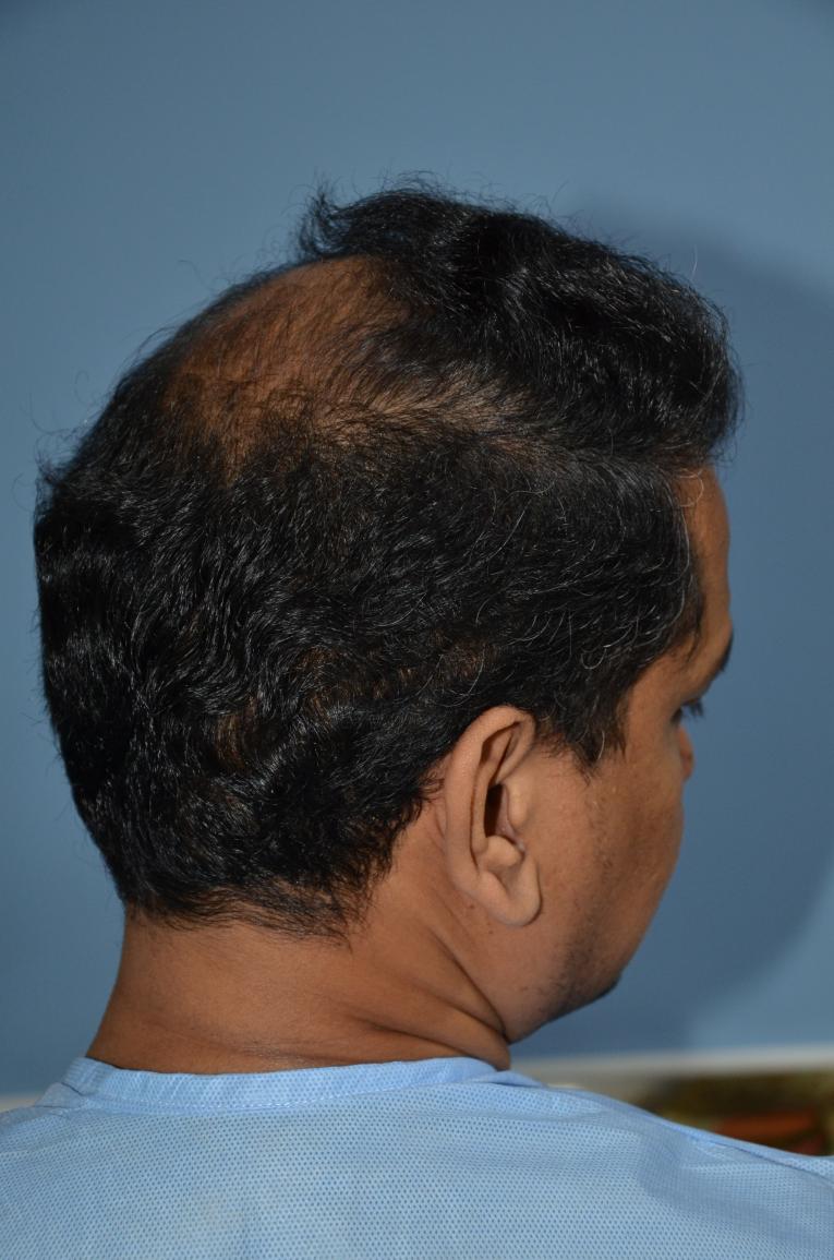 Click image for larger version

Name:	Darling Buds Hair Transplant Clinic (14).jpg

Size:	96.3 KB
ID:	57491