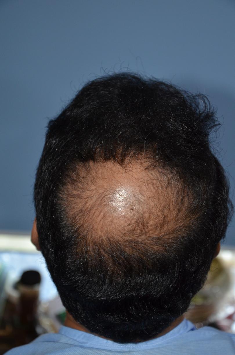 Click image for larger version

Name:	Darling Buds Hair Transplant Clinic (16).jpg

Size:	93.3 KB
ID:	57493