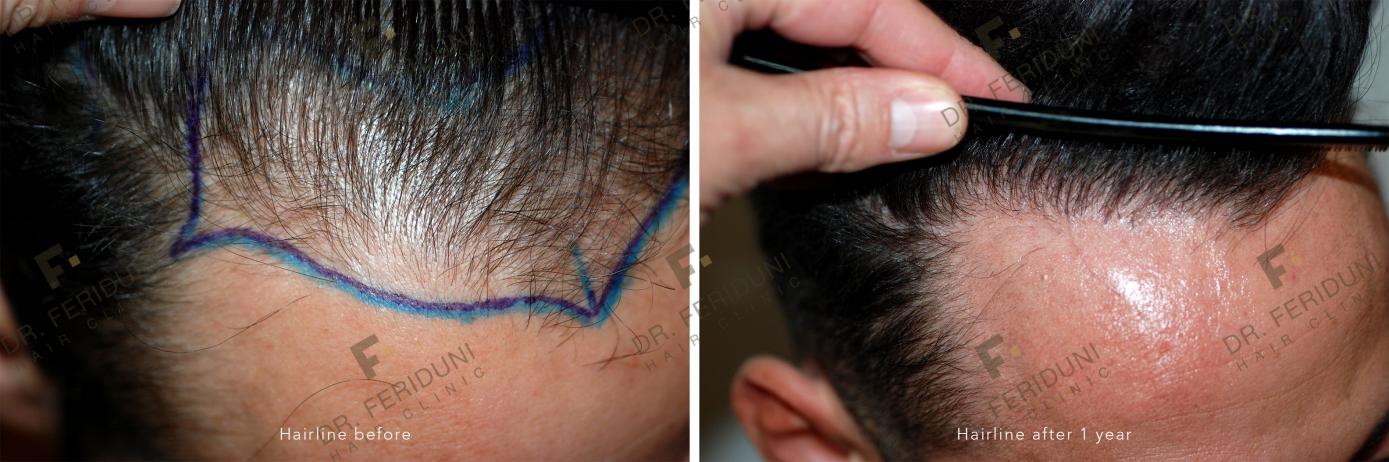 Image uploaded by: Dr Feriduni Hair Clinic