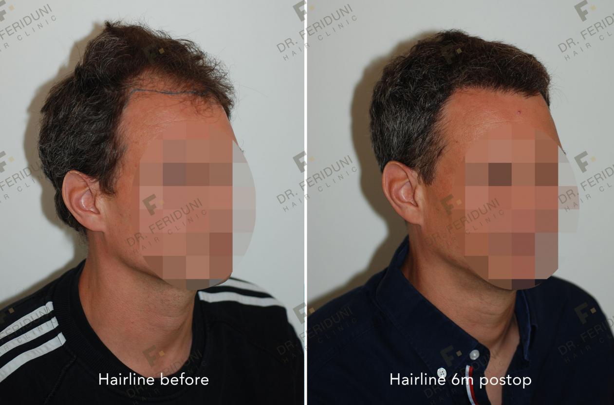 Image uploaded by: Dr Feriduni Hair Clinic