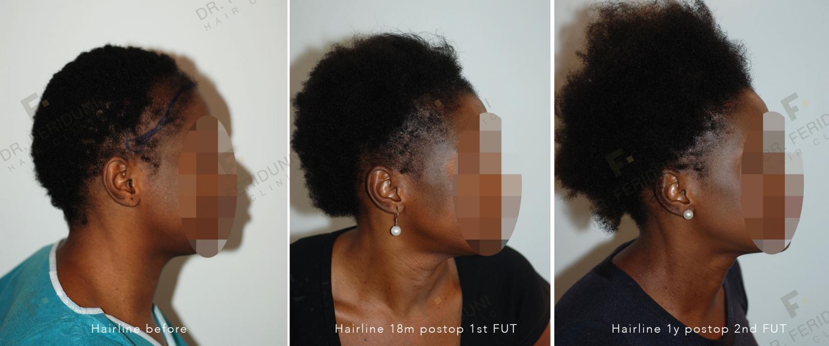 Image uploaded by: Dr Feriduni Hair Clinic