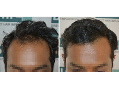 Mr. Sukrut, 26 hyrs, 3430  hair, 6 months