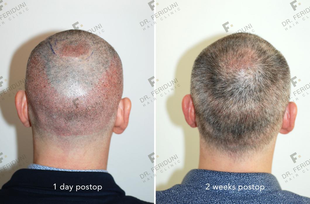 Image uploaded by: Dr Feriduni Hair Clinic
