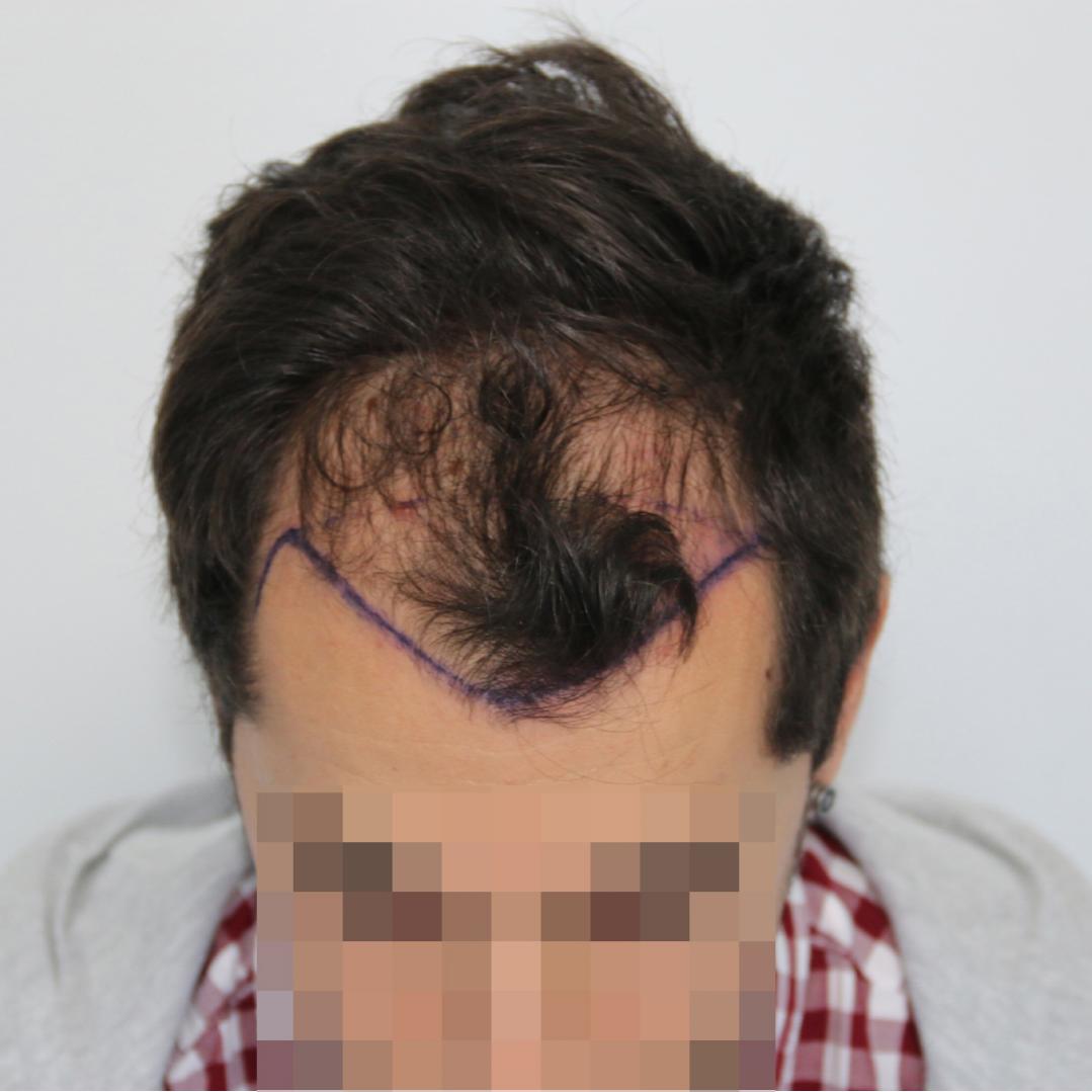 Image uploaded by: DrResulYaman