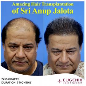 Image uploaded by: eugenixhairsciences
