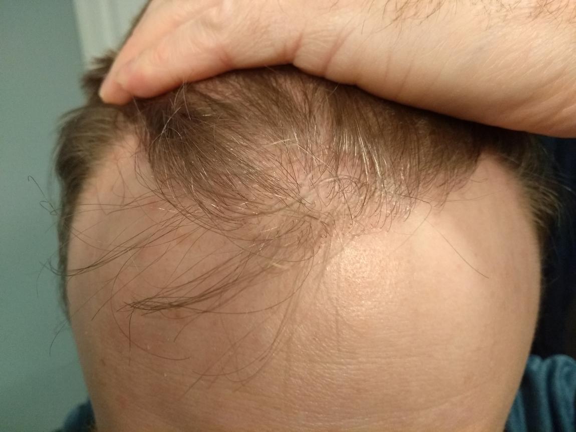 Image uploaded by: Hair073