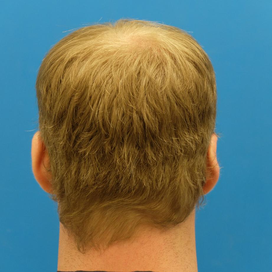 Image uploaded by: Hair073