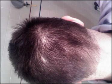 Click image for larger version

Name:	backofhead2.jpg

Size:	16.2 KB
ID:	7211