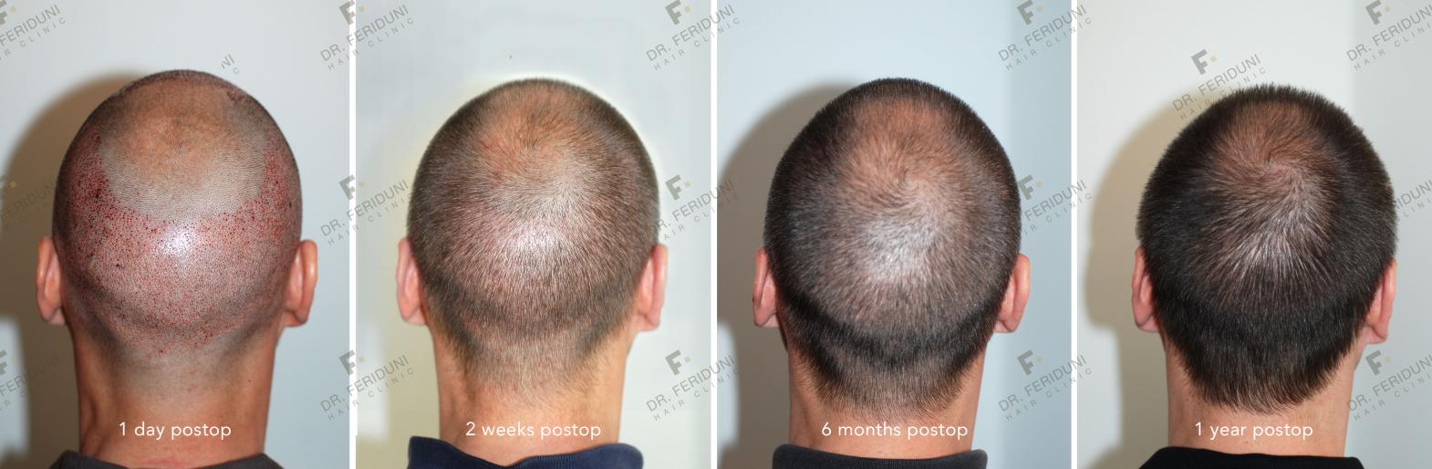 Image uploaded by: Dr Feriduni Hair Clinic