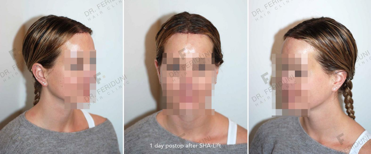 Image uploaded by: Dr Feriduni Hair Clinic