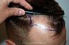 Image uploaded by: Dr Feriduni Hair Clinic