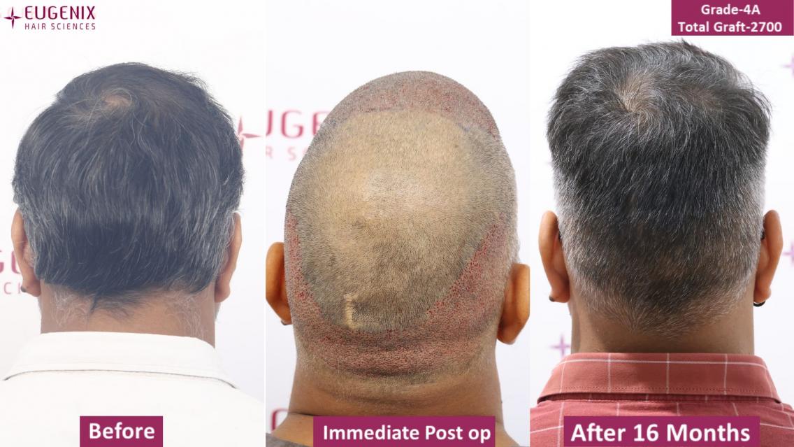 Image uploaded by: Pradeep Sethi, MD