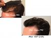 Click image for larger version

Name:	Hair Transplant Slides copy35.002.jpg

Size:	12.1 KB
ID:	46003