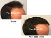 Click image for larger version

Name:	Hair Transplant Slides copy30.001.jpg

Size:	12.1 KB
ID:	45861