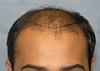 Click image for larger version

Name:	04_position-of-hairline.jpg

Size:	41.1 KB
ID:	6538