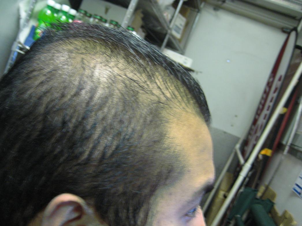 Click image for larger version

Name:	Balding Head2.jpg

Size:	90.8 KB
ID:	2463