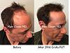 Click image for larger version

Name:	Hair Transplant Slides copy01.005.jpg

Size:	16.9 KB
ID:	50228