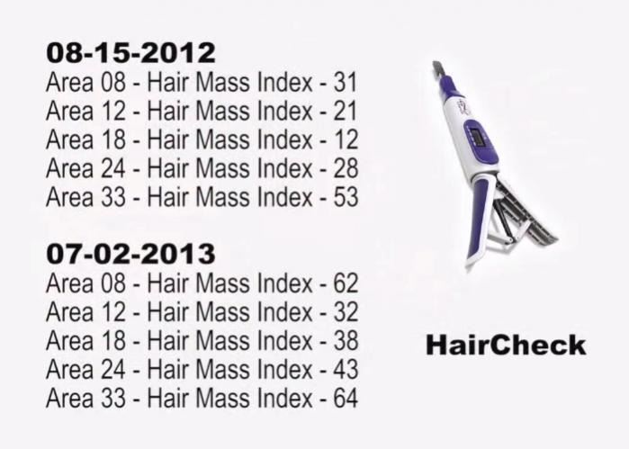 Click image for larger version

Name:	male-patient_HairCheck-Numbers.jpg

Size:	42.3 KB
ID:	35473