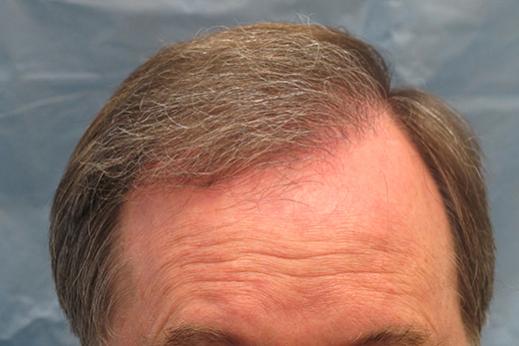 Click image for larger version

Name:	1c hairlined.jpg

Size:	24.5 KB
ID:	35824