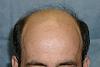 Click image for larger version

Name:	Detail of Hairline.jpg

Size:	16.7 KB
ID:	251