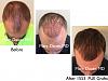 Click image for larger version

Name:	Hair Transplant Slides copy12.002.jpg

Size:	14.8 KB
ID:	43690