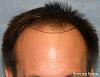 Click image for larger version

Name:	1100_2b_position-hairline.jpg

Size:	24.9 KB
ID:	45094