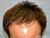 Click image for larger version

Name:	1100_3b_position-hairline.jpg

Size:	96.8 KB
ID:	45098