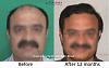 Click image for larger version

Name:	Dr-Pradeep-Sethi-Dr-Arika-Bansal-Eugenix-Result1.jpg

Size:	68.6 KB
ID:	60272