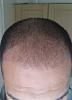Click image for larger version

Name:	Hair Pic 3mths.jpg

Size:	82.2 KB
ID:	63296