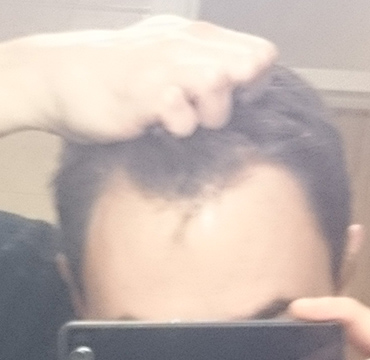 Click image for larger version

Name:	hairline2.jpg

Size:	65.8 KB
ID:	36069