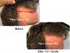 Click image for larger version

Name:	Hair Transplant Slides copy46.003.jpg

Size:	15.8 KB
ID:	46144