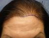 Click image for larger version

Name:	04_position-of-hairline.jpg

Size:	56.6 KB
ID:	9851