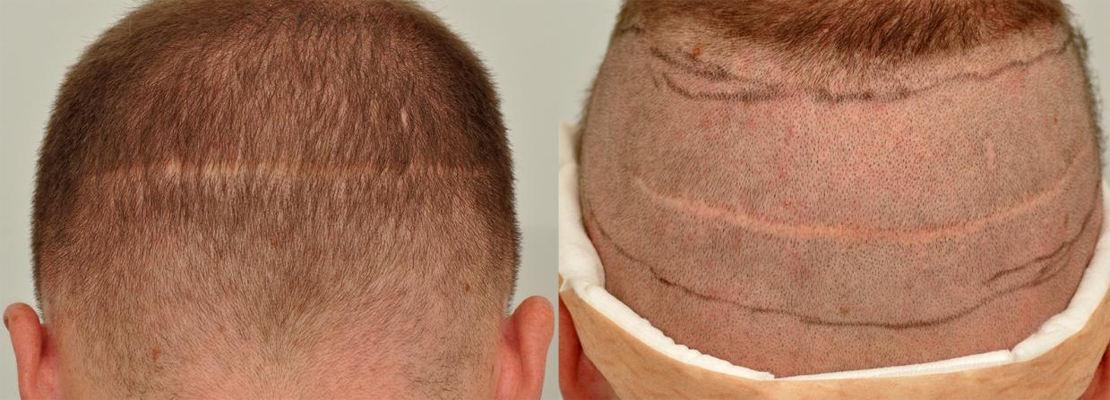 Click image for larger version

Name:	today-strip scar.jpg

Size:	97.8 KB
ID:	34455