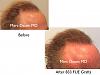 Click image for larger version

Name:	Hair Transplant Slides copy45.003.jpg

Size:	12.2 KB
ID:	46954
