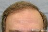 Click image for larger version

Name:	hairline-a2nd.jpg

Size:	64.9 KB
ID:	26309