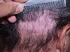 Click image for larger version

Name:	Before Scar Repair.jpg

Size:	96.5 KB
ID:	8531