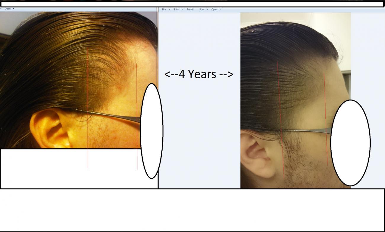Click image for larger version

Name:	Hair 4 years.jpg

Size:	90.8 KB
ID:	36715