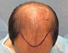 Click image for larger version

Name:	1098_3b_planned-hairline-top-view.jpg

Size:	48.2 KB
ID:	24518