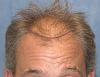 Click image for larger version

Name:	04_position-of-hairline.jpg

Size:	64.6 KB
ID:	7531