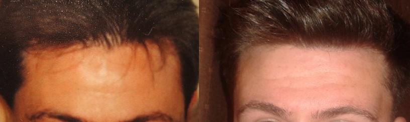 Click image for larger version

Name:	Me and my dad's hairline..jpg

Size:	23.7 KB
ID:	41075