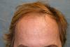 Click image for larger version

Name:	1a-hairline.jpg

Size:	22.2 KB
ID:	35817