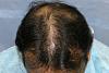 Click image for larger version

Name:	03_before-hair-repair-top-view.jpg

Size:	57.0 KB
ID:	12691