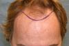 Click image for larger version

Name:	1b-hairline.jpg

Size:	14.2 KB
ID:	35818