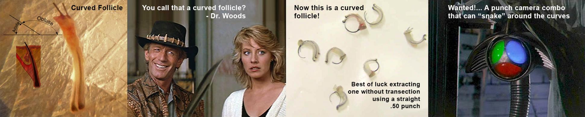 Click image for larger version

Name:	Curved Follicle.jpg

Size:	104.7 KB
ID:	34216
