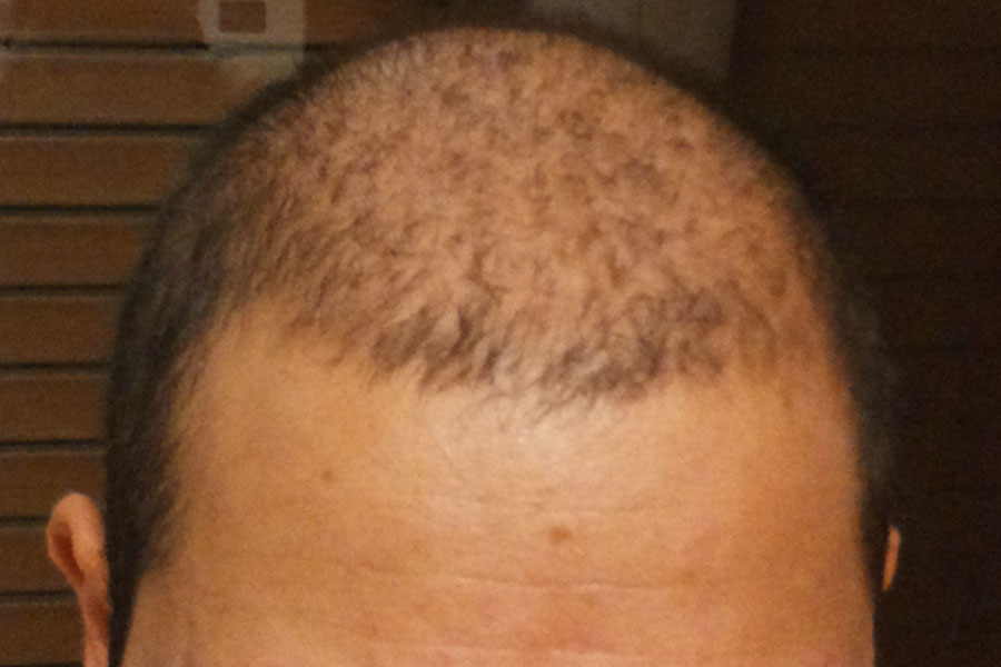 Click image for larger version

Name:	bald2.jpg

Size:	68.1 KB
ID:	37666