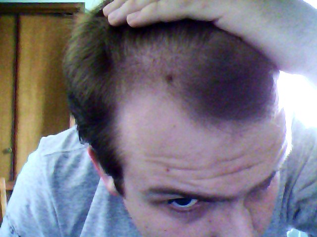 Click image for larger version

Name:	Hairline.JPG

Size:	52.0 KB
ID:	14910