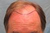 Click image for larger version

Name:	1b hairline.jpg

Size:	22.6 KB
ID:	35823