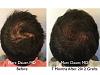 Click image for larger version

Name:	Hair Transplant Slides copy63.005.jpg

Size:	16.8 KB
ID:	47140